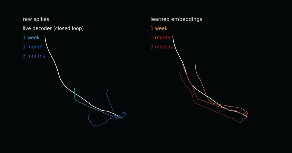 Neuralink: 50 000 heures de préentraînement cérébral et record 11,32 BPS